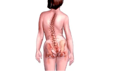 Awọn idi fun idagbasoke ti osteoclondrosis