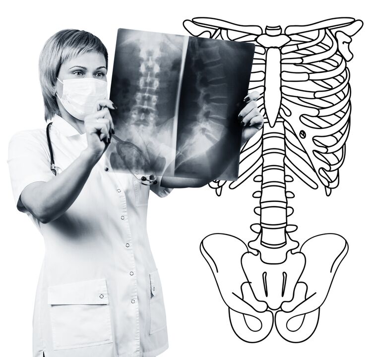 Roodgraphy ti ọpa ẹhin lumbar
