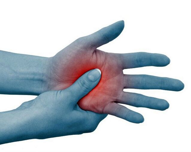 Irora nla ni awọn isẹpo ti awọn ika ọwọ, dinku pẹlu idaraya, jẹ ami aṣoju ti arthritis rheumatoid. 