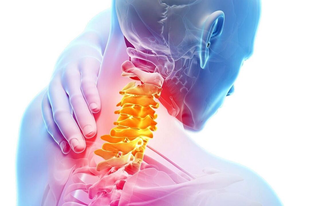 irora pẹlu osteochondrosis cervical